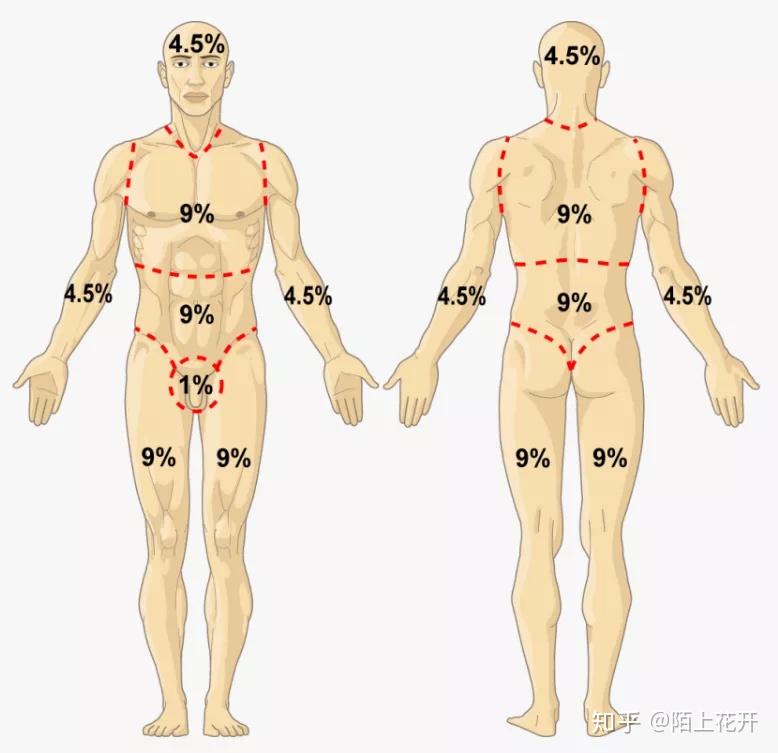 一勞永逸解決rn考試中計算燒傷面積的題又快又準