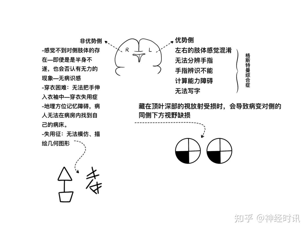 脑皮层的分叶、额叶及顶叶的结构、功能及受损表现【全了】 - 知乎