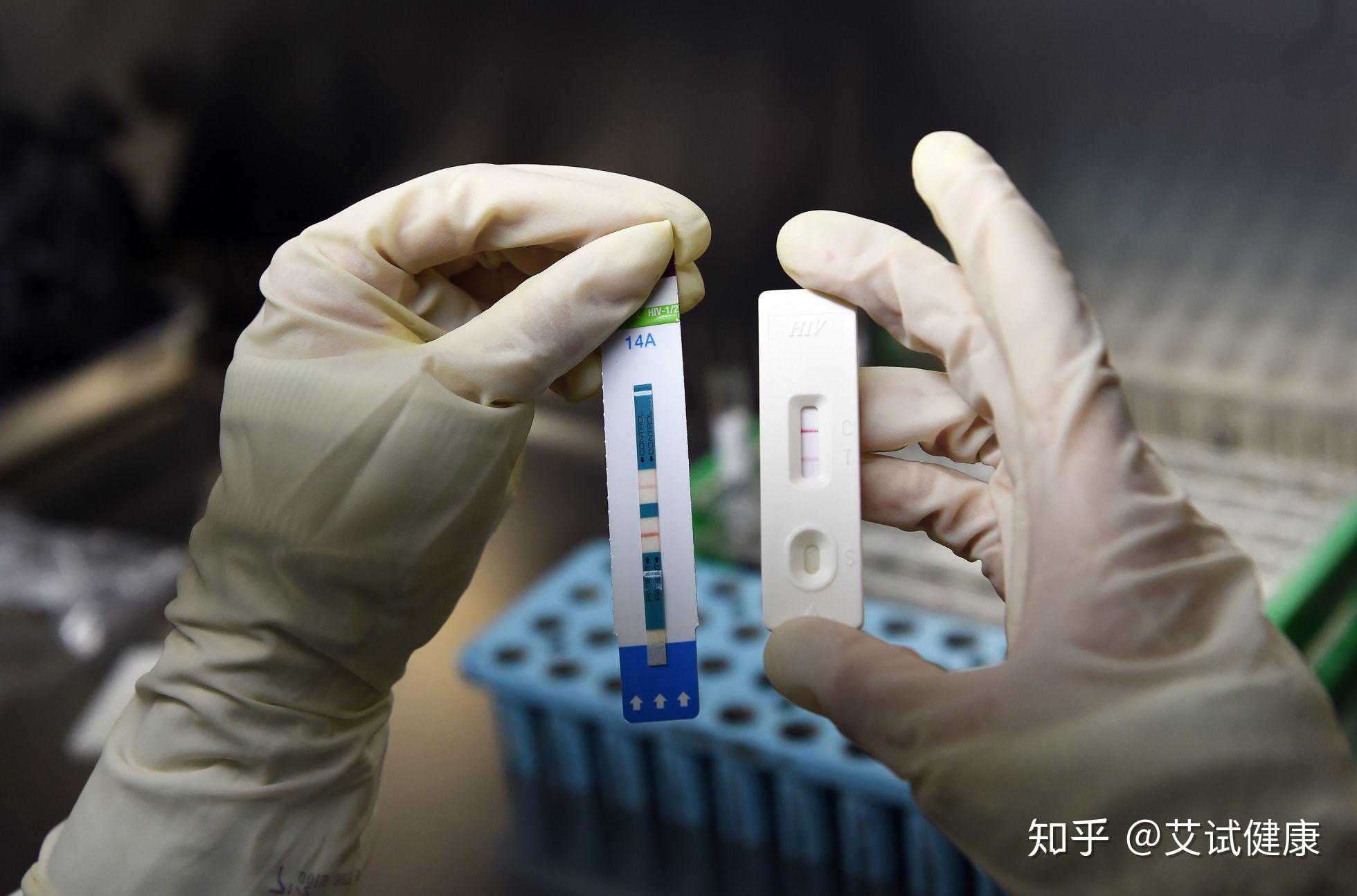 艾滋病试纸的包埋线是怎么回事