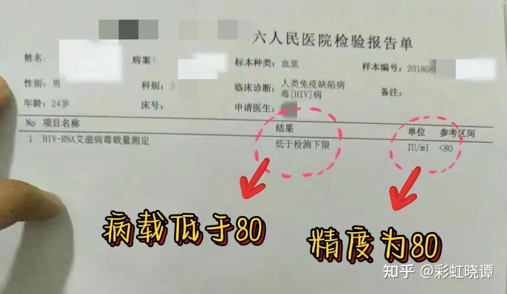 关于艾滋病病毒载量的相关问题