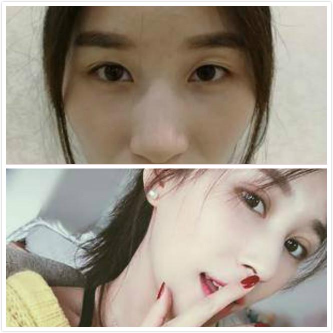 怎么拥有大眼睛和双眼皮 v2-f89bde3f12b9cd6851c83683e11cc96e_1440w.jpg?source=172ae18b