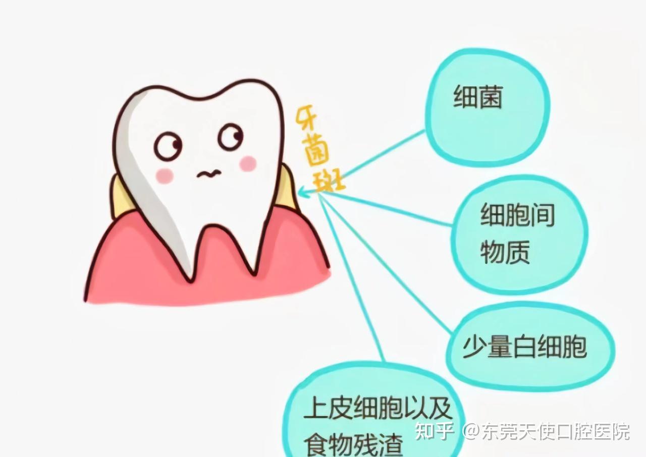 什么是牙菌斑指示剂？ - 知乎