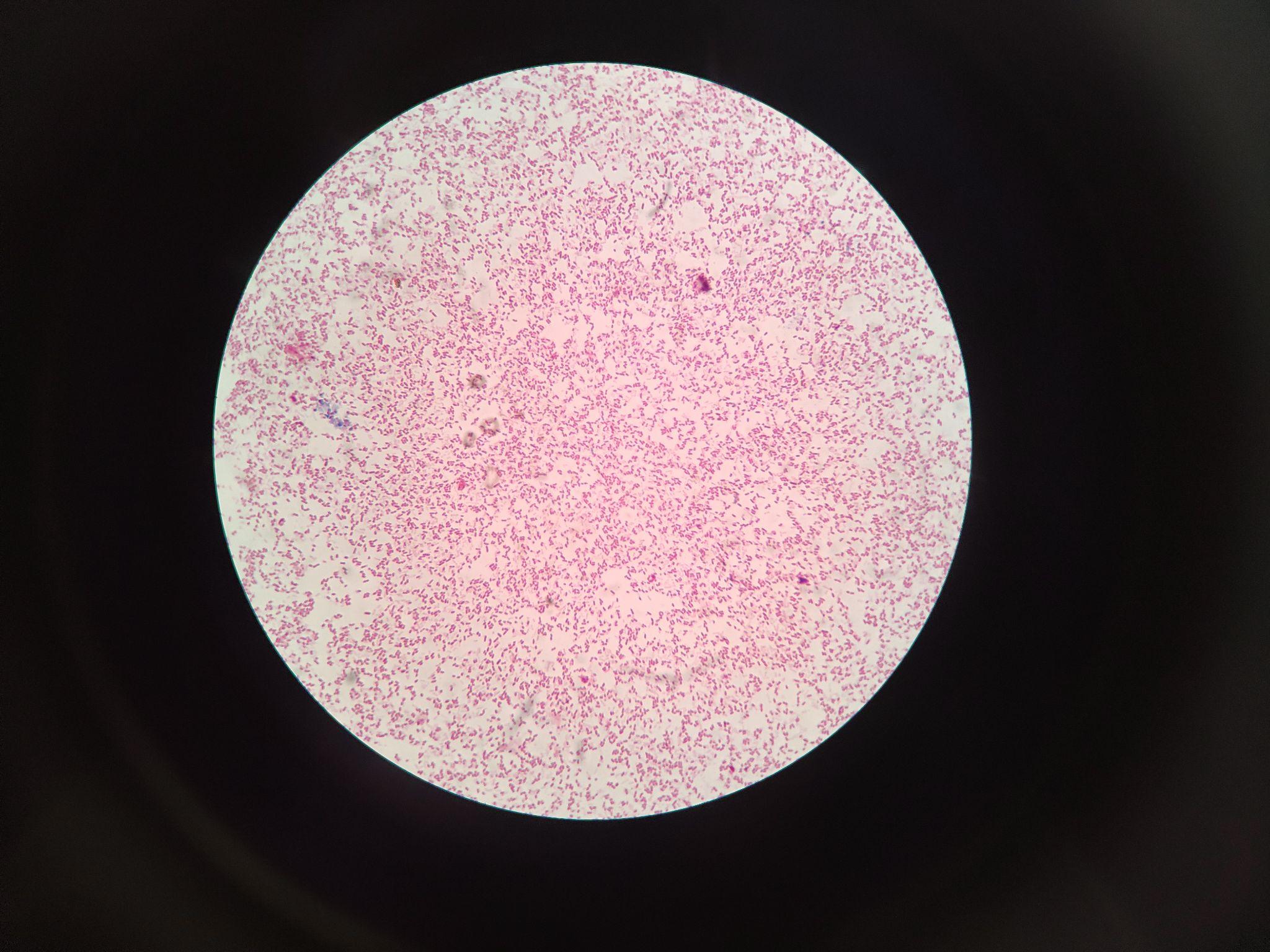 v2-f8d2161969db07b7f424e4b2d6f52f32_r.jpg
