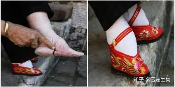 网红束腰正在毁掉6亿中国女孩