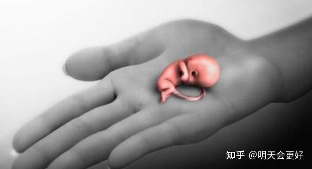 胎儿流产图图片