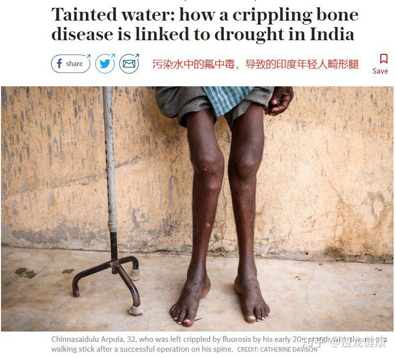 氟在人体具有累积效应,我们每天喝水,刷牙,但很少会有人留意,氟化物