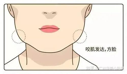 成年人“发腮”有得解,4个方法助你回归小V脸! - 知乎