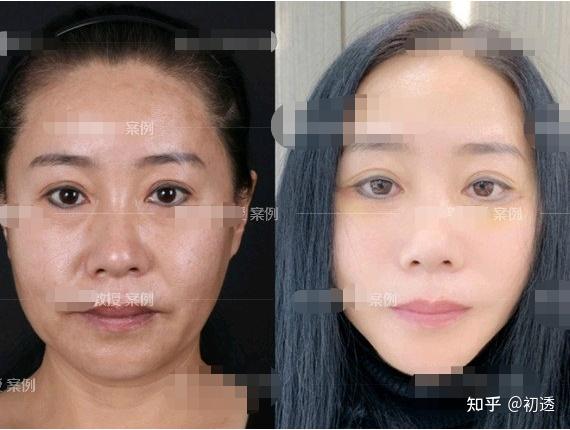 北京地壇醫(yī)院、號(hào)販子代掛號(hào)，交給我們，你放心權(quán)威手術(shù)專家的簡單介紹