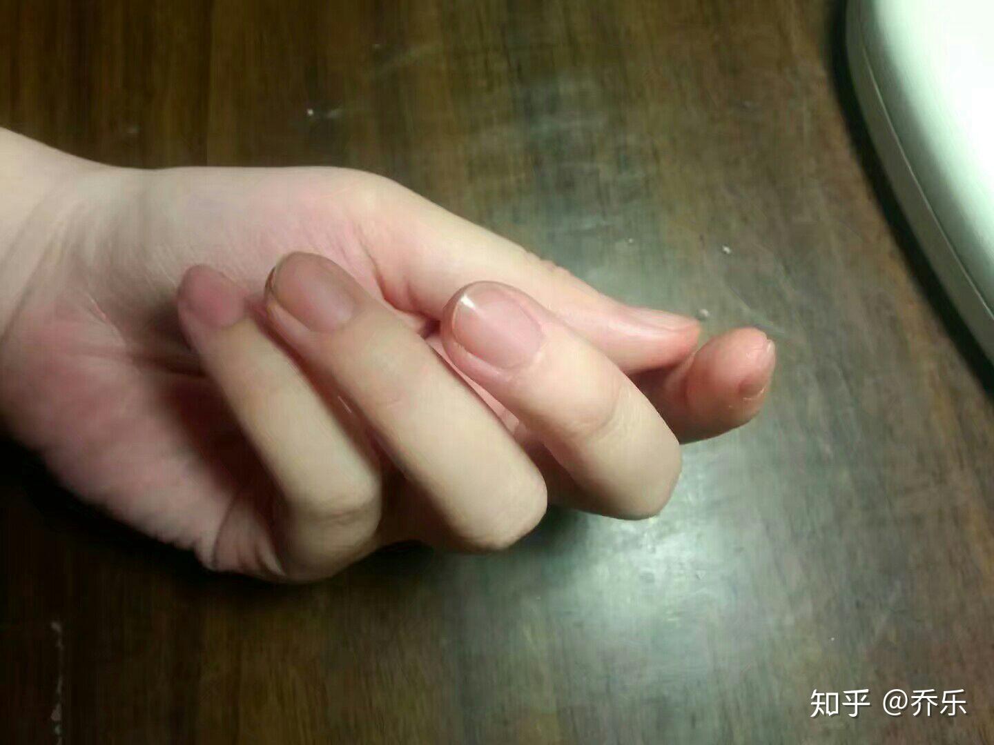你见过最好看的女孩子的手是什么样的?