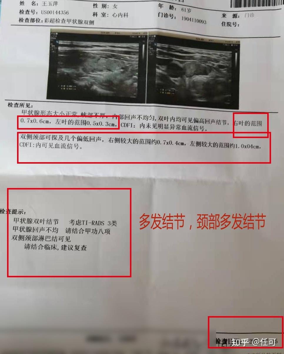 甲狀腺結節患者舌尖發麻是正常現象嗎