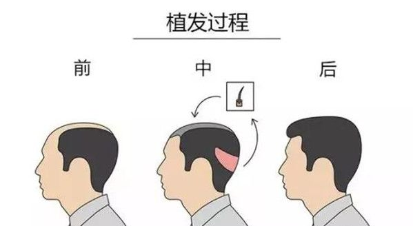 v2-f9f3e03b9f81d8cfa8645b347caba39c_1440w.jpg?source=172ae18b