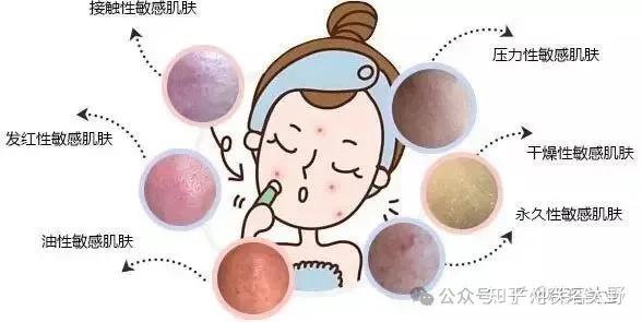 舒敏之星:修复肌肤屏障的不二之选,是当之无愧的敏感肌救星! - 知乎