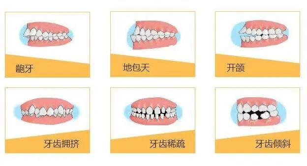 v2-fab310e3a85e6eb655ecf49415716517_1440w.jpg?source=172ae18b