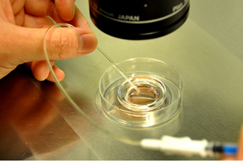 冻胚移植的全过程 - 知乎