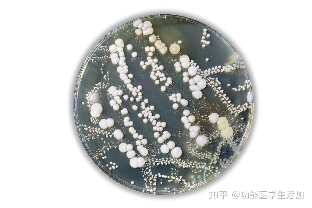 米酵菌酸是一种食物中毒常见原因,由椰毒假单胞菌属酵米面亚种产生,在