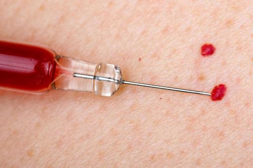 成人面颊部蔓状血管瘤怎么办