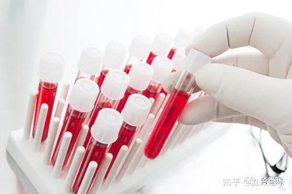 【名医】血生化报告阅读——血脂谱的改变 - 知乎