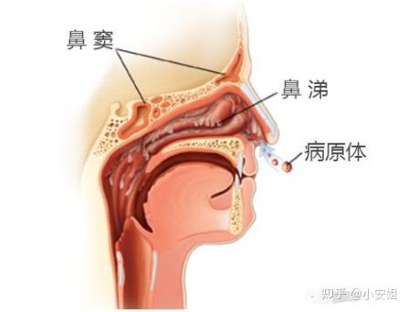 鼻窦积液排出姿势图片