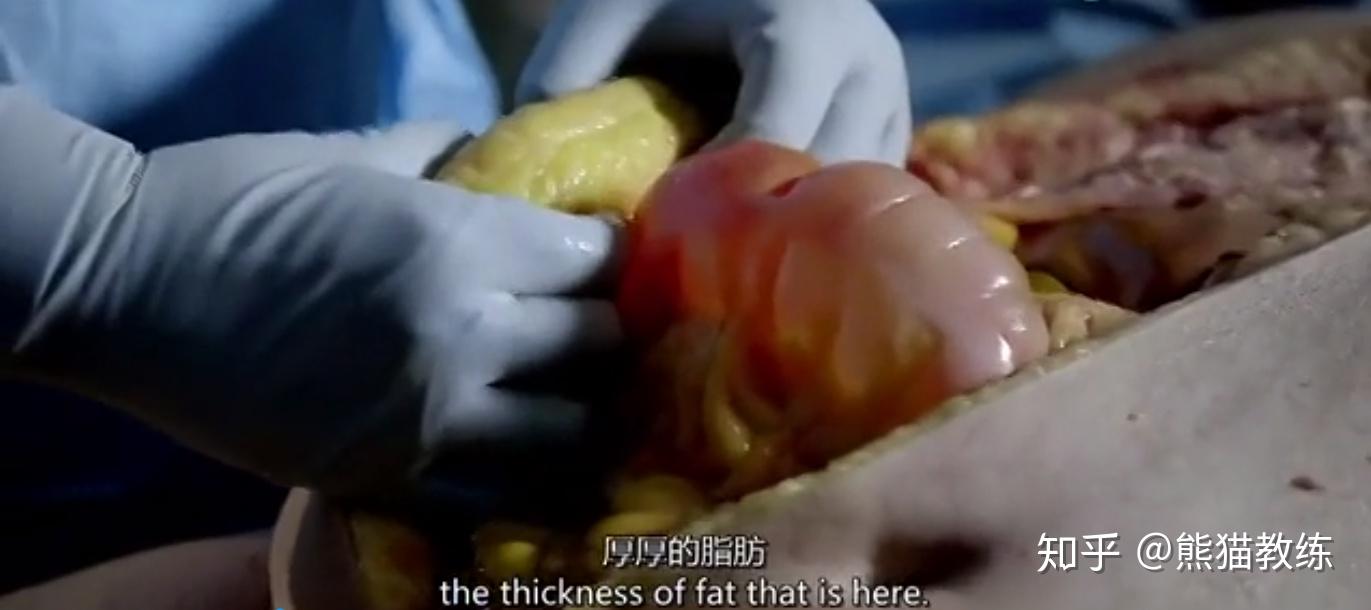 瑟瑟发抖肥胖对身体影响有多大bbc解剖了一位200斤的胖子