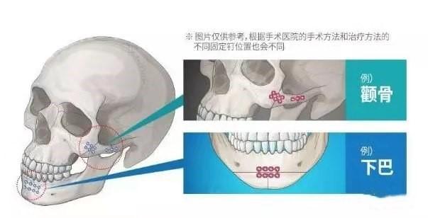v2-fbb5fae80e1b76be1cd23b0326eb3354_1440w.jpg?source=172ae18b