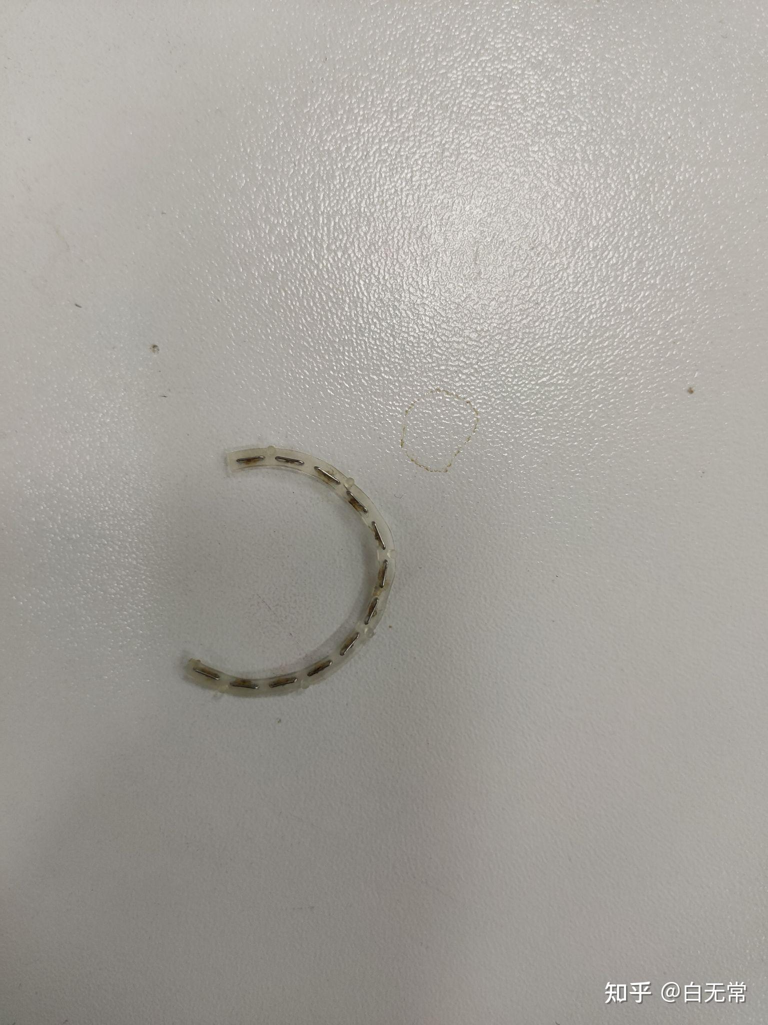 给知友说说我做环切包皮的事 - 知乎