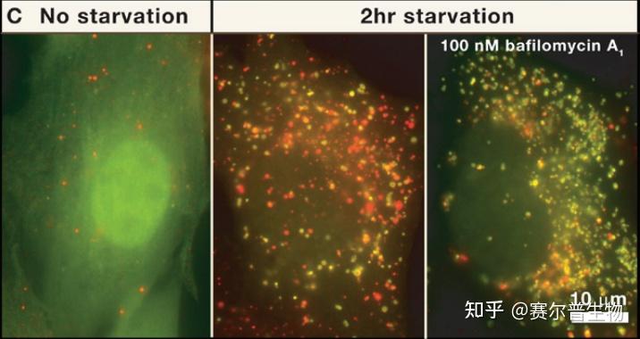 细胞自噬看这篇：发生机制/检测方法/研究思路！看完全明白！ - 知乎