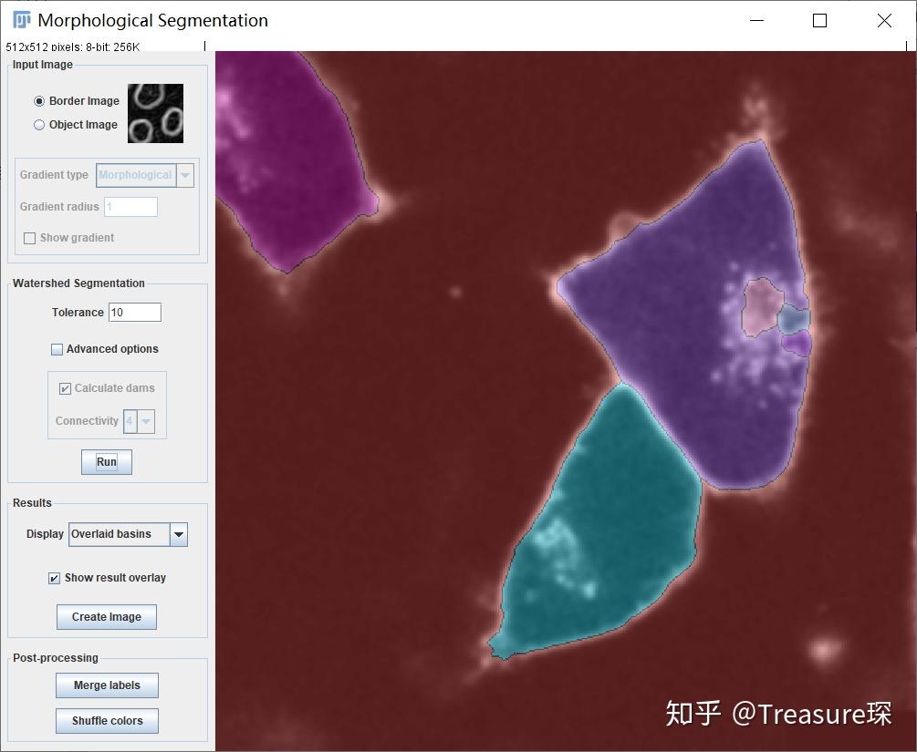 ImageJ实用教程——细胞膜荧光强度检测(定量分析篇) - 知乎