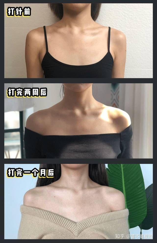 如何瘦出天鹅颈 v2-fc0df2fdfd104e157d7d4de1fb4cadf2_r.jpg