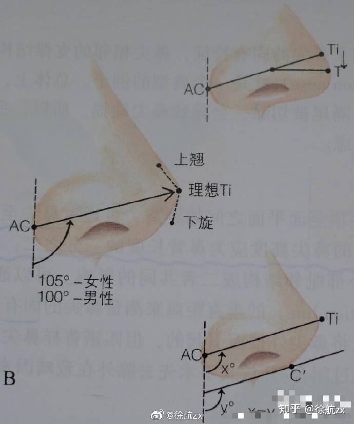 鼻尖下小叶图片