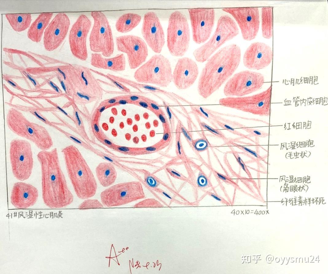 肌组织红蓝铅笔手绘图图片