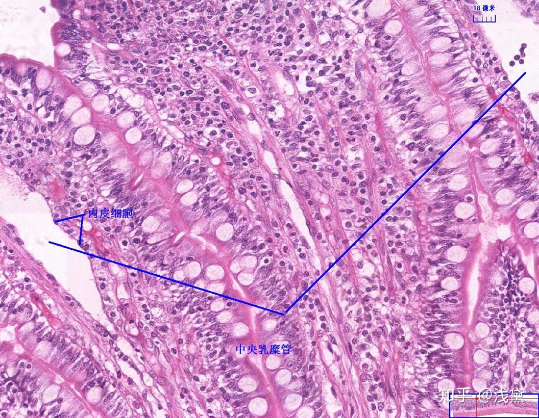 5.甲状腺(甲状腺滤泡,滤泡旁细胞)