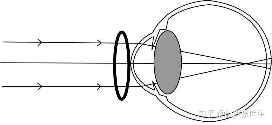 v2-fc65dca290aa88daa2828238808ee18e_r.jpg