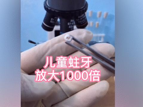 兒童蛀牙放大1000倍密密麻麻的蟲子太噁心媽媽咋保護娃的牙齒