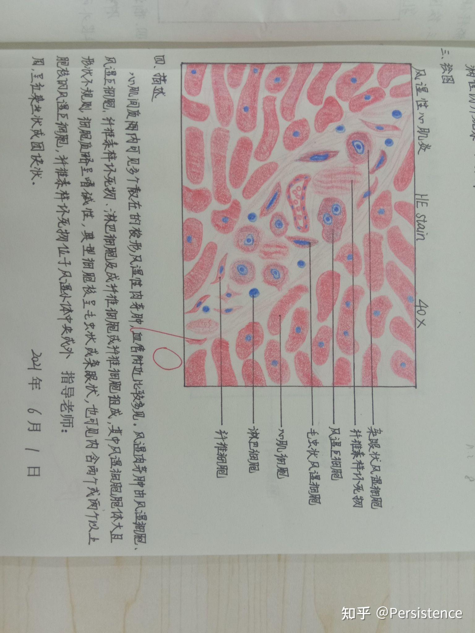 炎性细胞的红蓝手绘图图片
