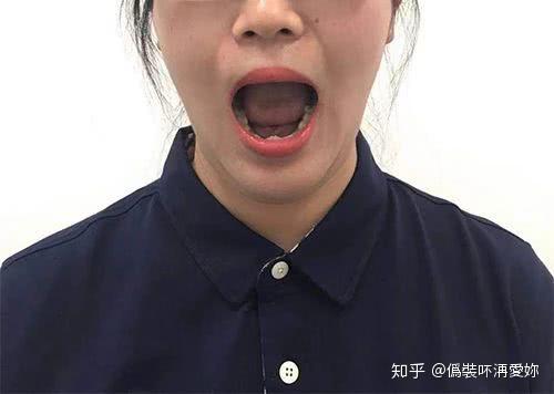 中风后面瘫该怎么办