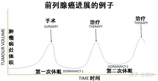 癌症为何会休眠 如何杀死休眠中的癌细胞 知乎