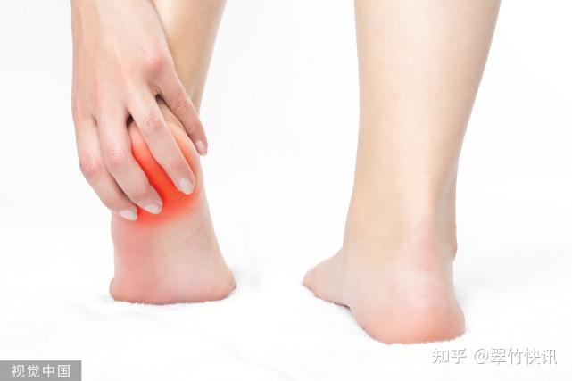 三天治好五年的足跟痛你是不是也在找这些方法