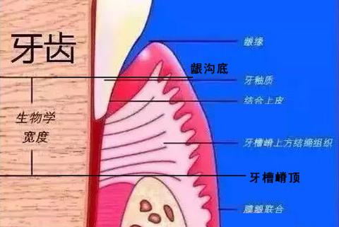 补牙继发龋齿问题