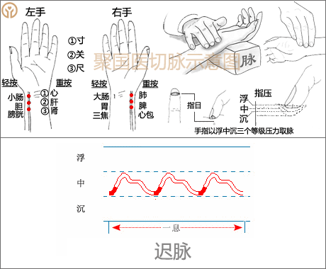 脉诊经典要略 - 知乎