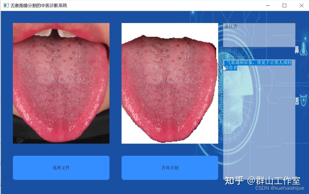 基于深度学习面向中医诊断的舌象图像分割系统 - 知乎