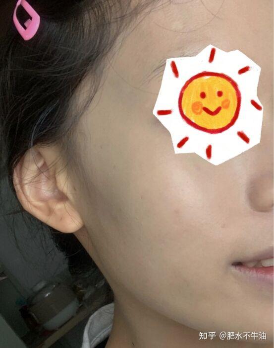 夏天到了怎么防晒和美白