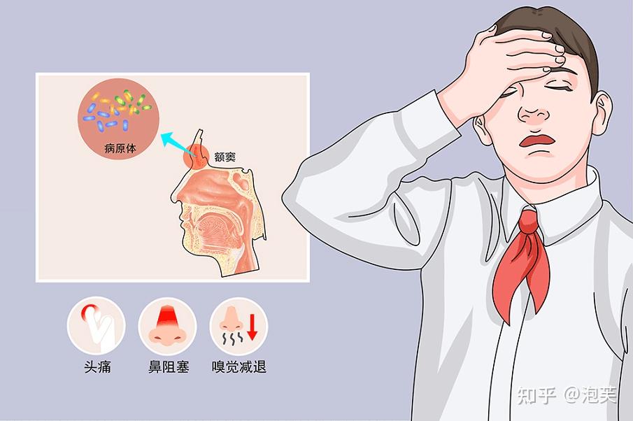 鼻炎可以彻底根治吗 - 知乎