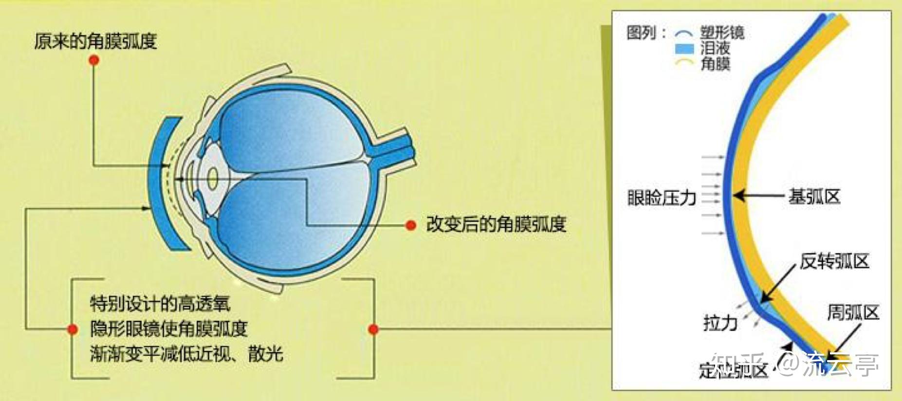 角膜反射弧图片