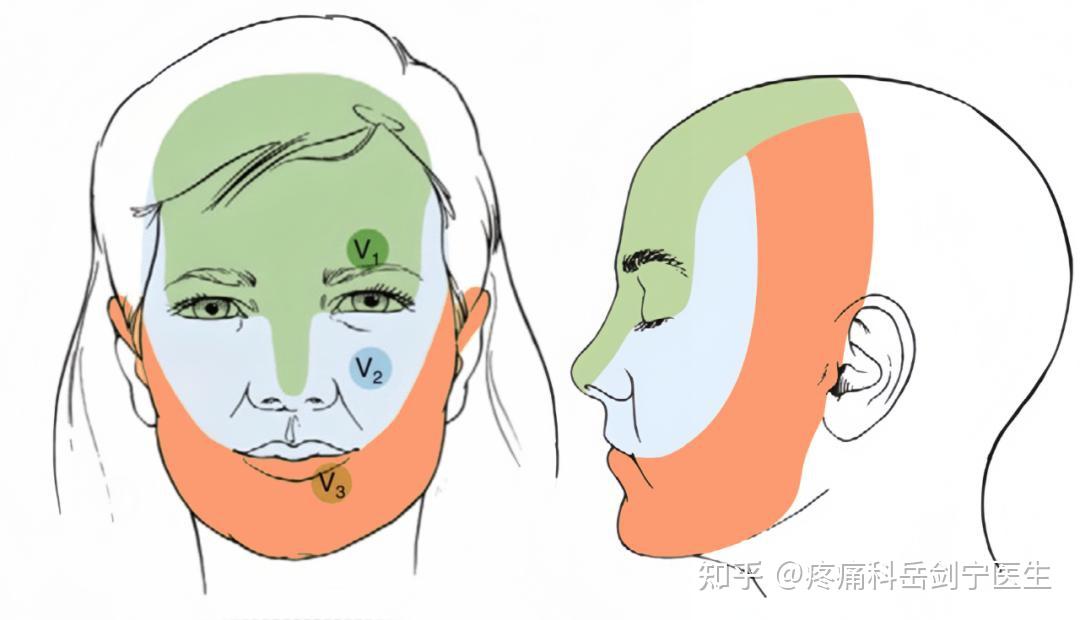 天下第一痛“三叉神经痛”,到底有多痛? - 知乎