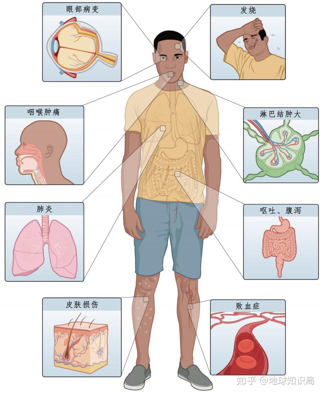 朊病毒在人体分布图片