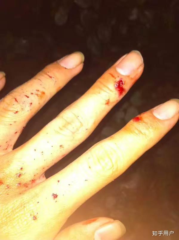 着耳鸣,然后整个人都是懵逼的状态,大概两三秒后,才感觉到手上不对劲