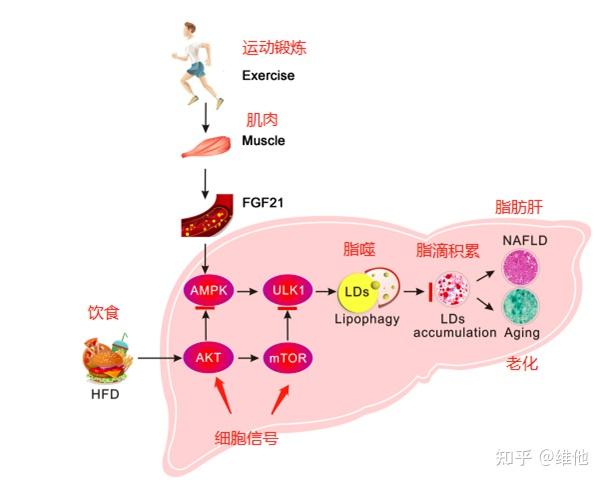 非酒精性脂肪肝上篇饮食调整不一定减肥运动不一定带氧