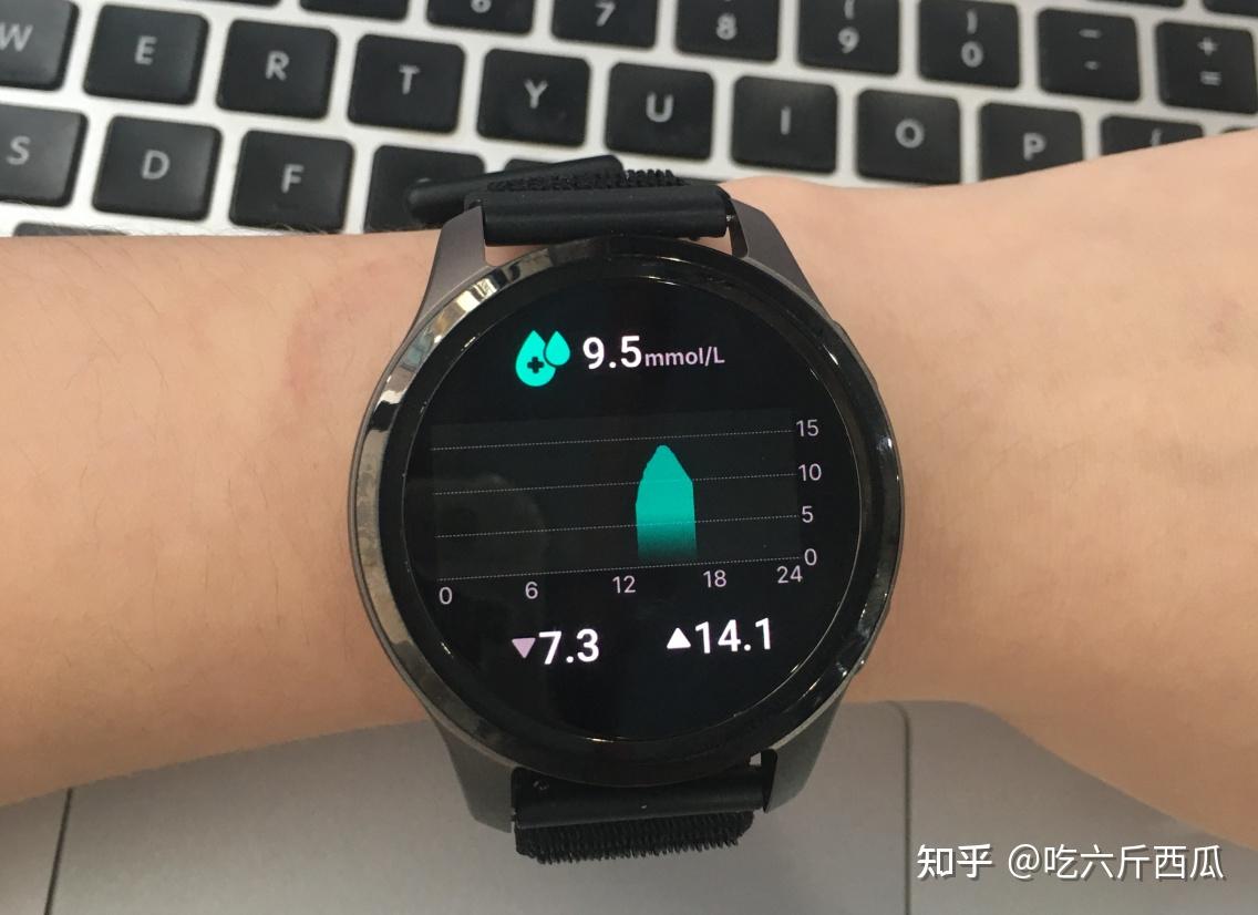 28 天深度实测糖记星测糖手表:告别频繁扎针,无创动态血糖监测真实体验