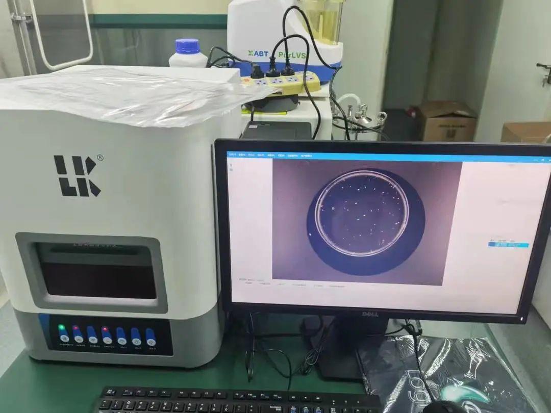 全自动菌落计数仪让计数更容易让检测更加精准,便捷,可靠