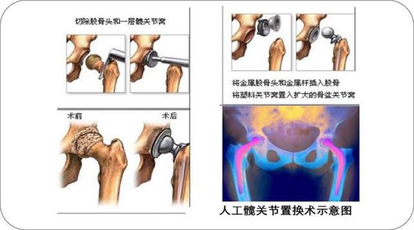 坏哪换哪 当我们已经能像生化人一样随意更换肢体 你会害怕么 知乎